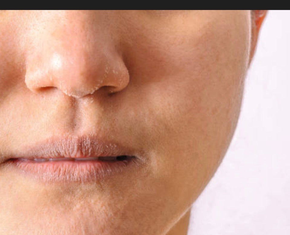 For dry skin solution